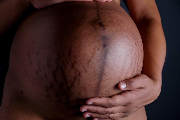 Ventre femme enceinte Martinique
